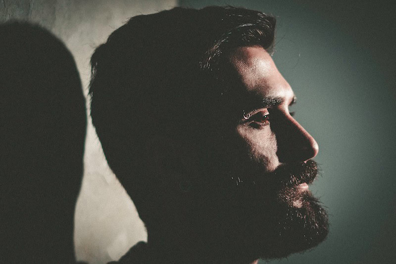 men's hair loss